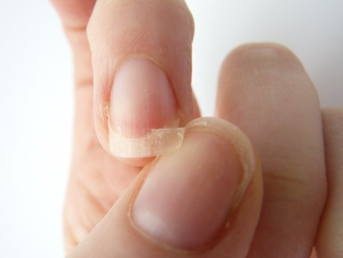 Cách chăm sóc móng để ngăn ngừa rạn nứt móng tay – Xu Hướng Nail Zone